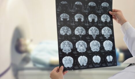 Neurology & Stroke